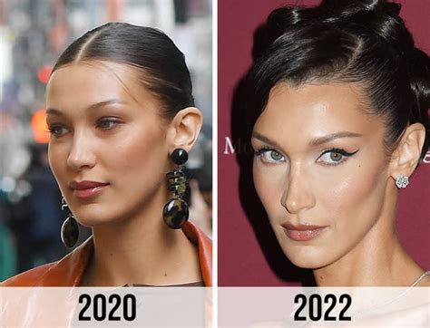 bella hadid buccal fat removal|6 ways to get a slimmer face – and not just buccal fat removal